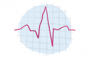 ElectroCardioGram